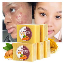 Load image into Gallery viewer, Turmeric Soap with Ginger, Vitamin C and Olive oil  for a brighter and more refreshing skin (7.5 oz) bar
