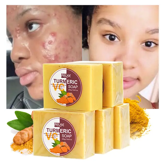 Turmeric Soap with Ginger, Vitamin C and Olive oil  for a brighter and more refreshing skin (7.5 oz) bar